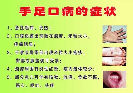 婴儿的护理举措,婴儿的护理主要是哪些方面