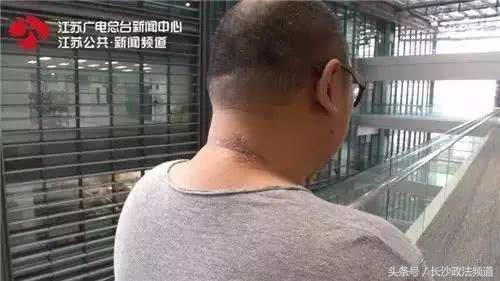 最近在家或外出都要小心它！一周内已有多人中招进了医院