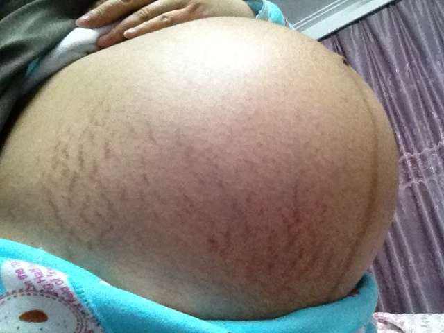 产前诊断医生为什么往坏处说,产前医生会问什么问题