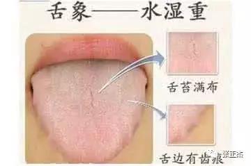 为什么吃抗生素会犯妇科病,妇科病老是反复用点啥药