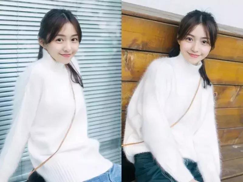 提高颜值是真的吗,发际线后移颜值下降