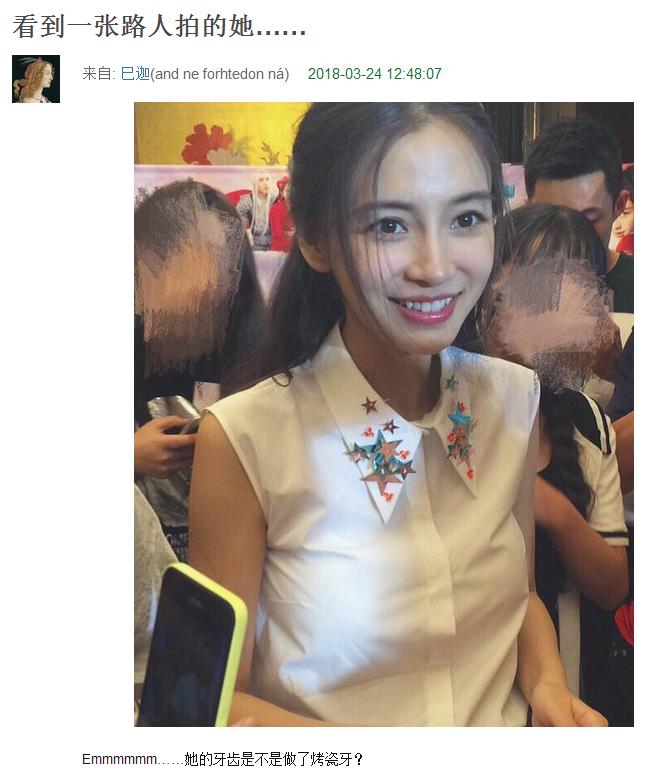 高圆圆戴牙套前后对比,高圆圆牙齿矫正牙套戴了几年