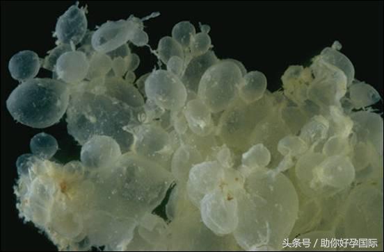 孕早期出血就是流产吗,孕早期出血就是流产征兆