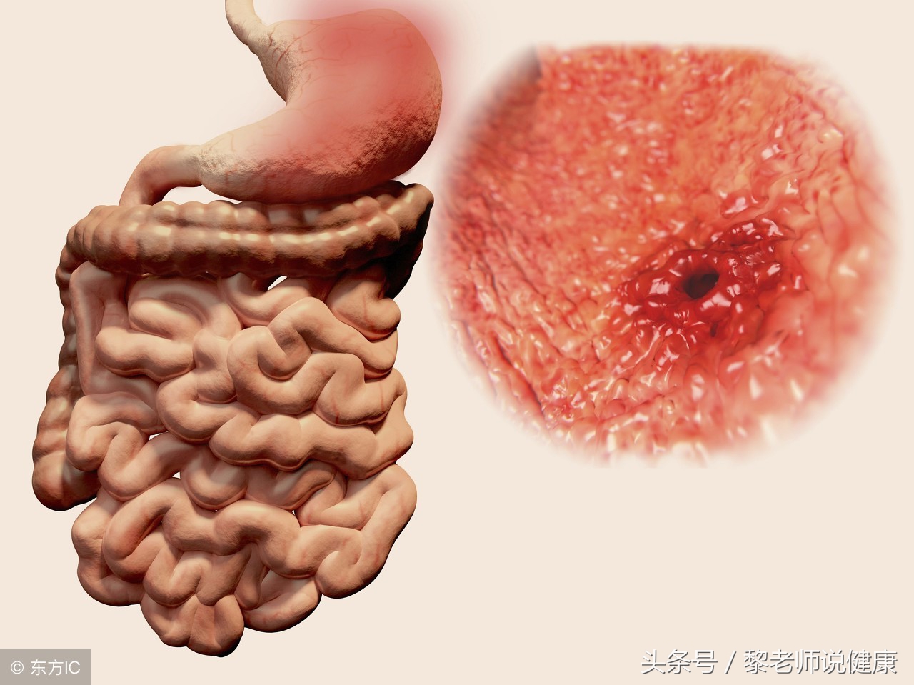 竹笋是发物吗肿瘤病人能不能吃,竹笋是发物吗哪些人不能吃减肥