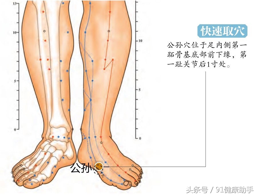 中医针刺肠胃穴位,胃痛按公孙穴