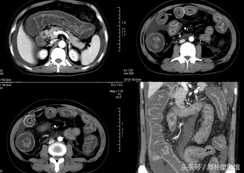 腹痛吃了药没效果,腹痛伴随呕吐怎么办