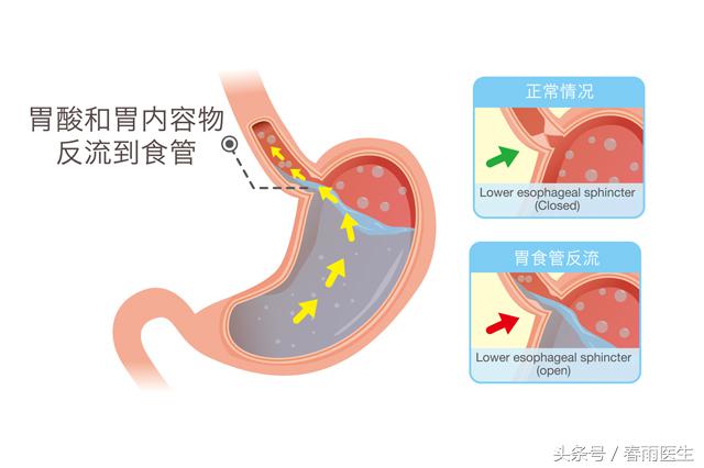 吃饭喝水食管痛是癌症吗,吃饭喝水食管哽咽什么原因