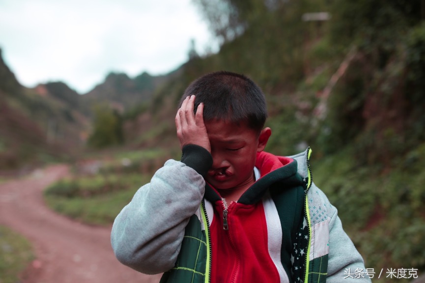 唇腭裂变帅,变帅的孩子