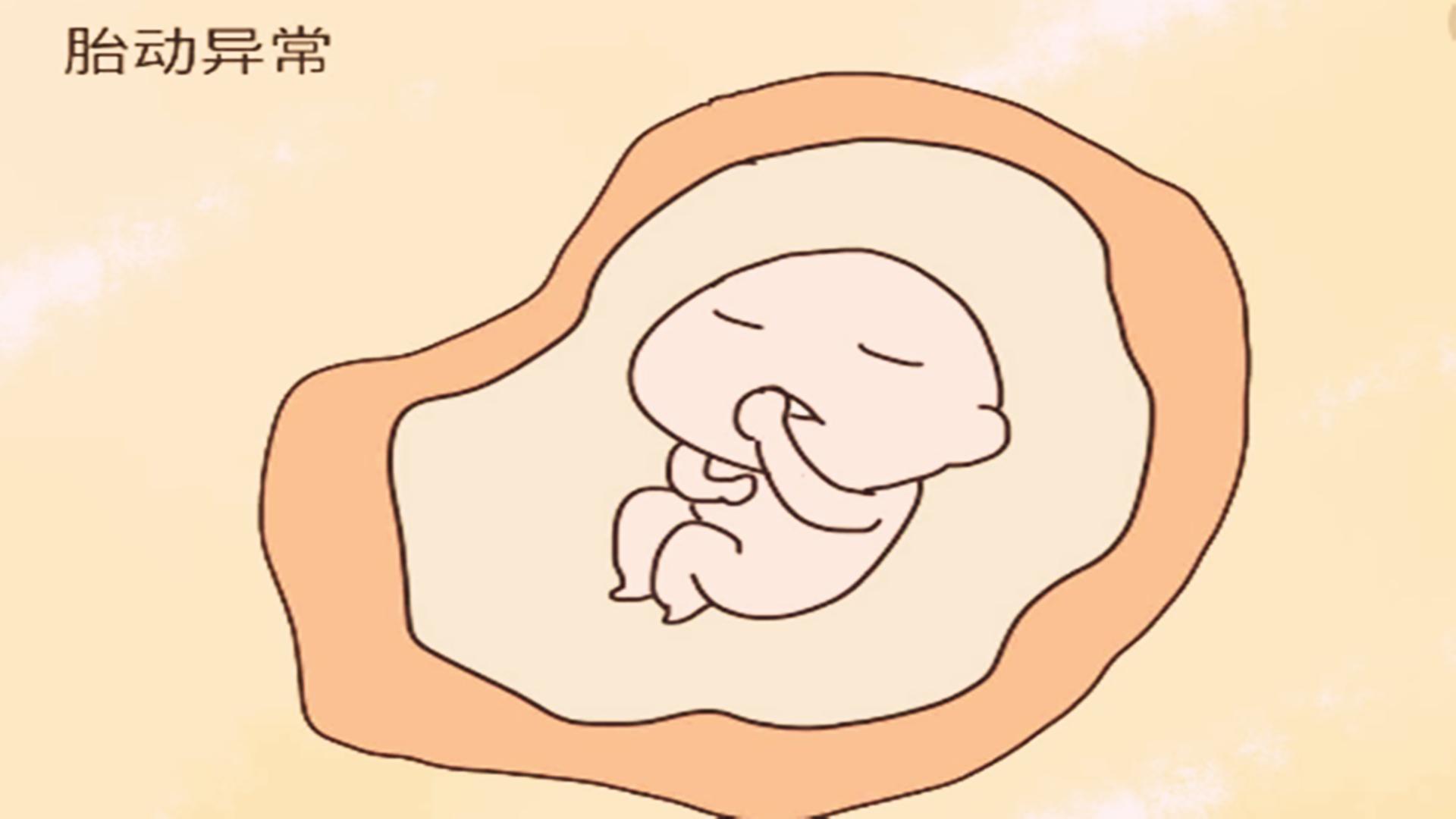 孕期要警惕4种胎动异常,孕期胎儿胎动大原因有哪些