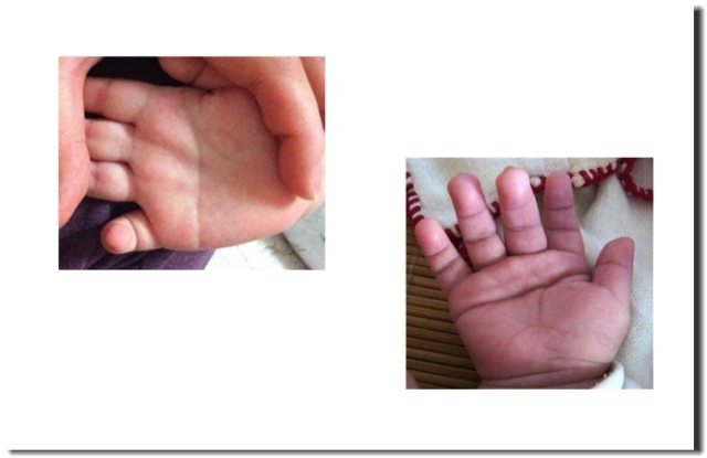 掌纹非常清晰还有很多小掌纹,掌纹突然出现大凶掌纹啥样