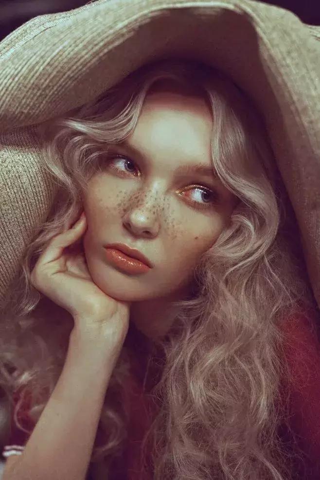 雀斑和痣斑的区别,雀斑样痣和雀斑的区别图片