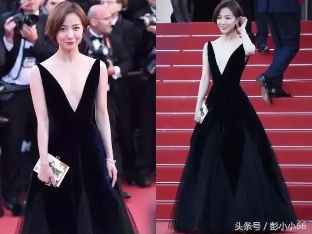 你好，你胸部外扩吗？