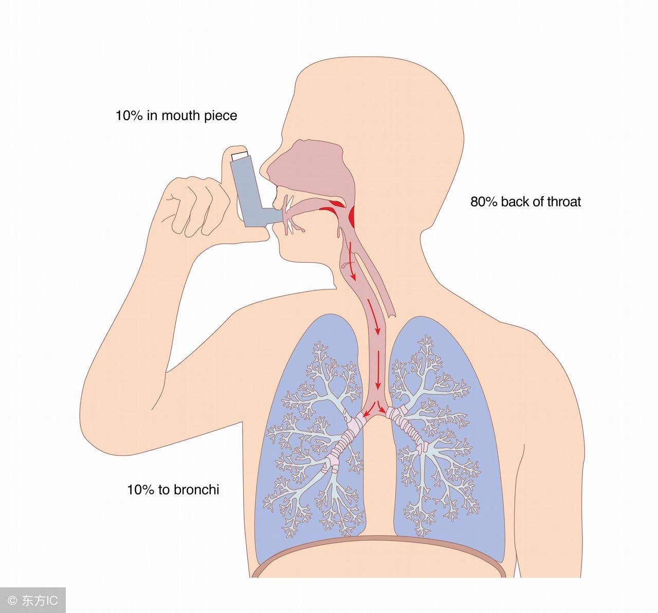 雾化的药物中不都是激素么？激素怎么能够随便给孩子用呢？