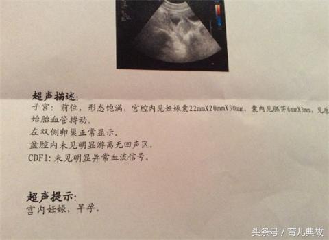 怀孕初期肚子突然抖动,孕妇生下女婴丈夫吓晕下集