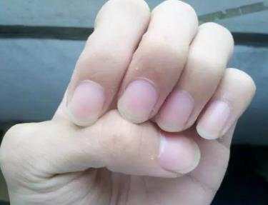 肝癌发生前几个明显信号要注意,肝癌早期症状隐藏五类人群需警惕