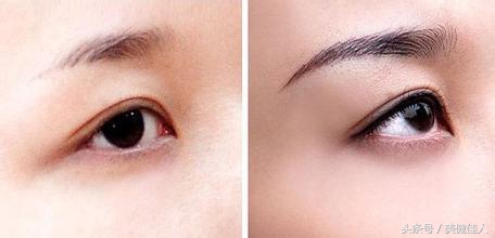 眉形改造系列,眉形改造眉形设计
