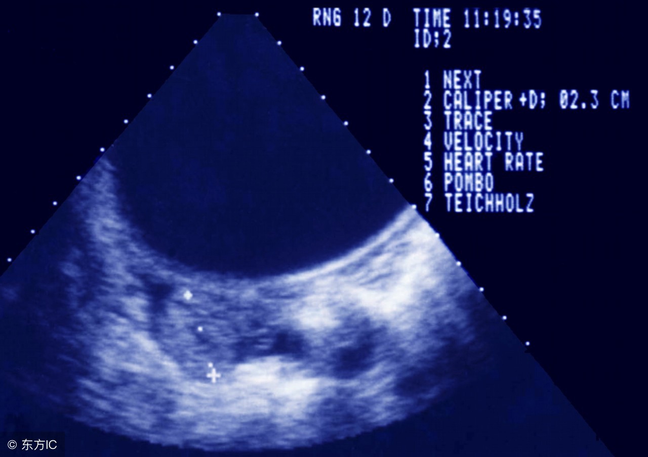 异位妊娠宫外孕区别,异位妊娠宫外孕