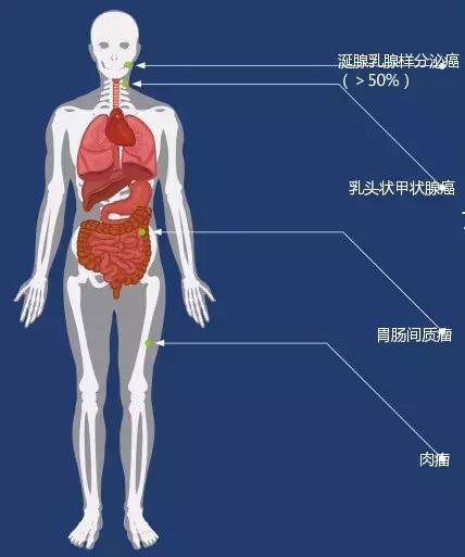 膀胱肿瘤的新疗法,最新治疗肿瘤的特效药