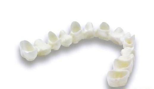 义齿3d金属打印机视频,义齿数字化3D激光打印系统