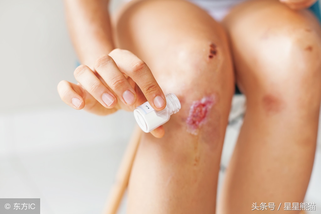 面部手术伤口预防感染,手术伤口怎么预防留疤