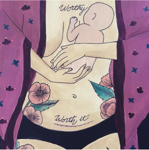 剖宫产并发症怎么治疗,剖宫产并发症是什么