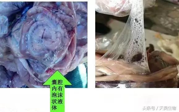 万病之源始于毒素,万病之源起于情志不畅