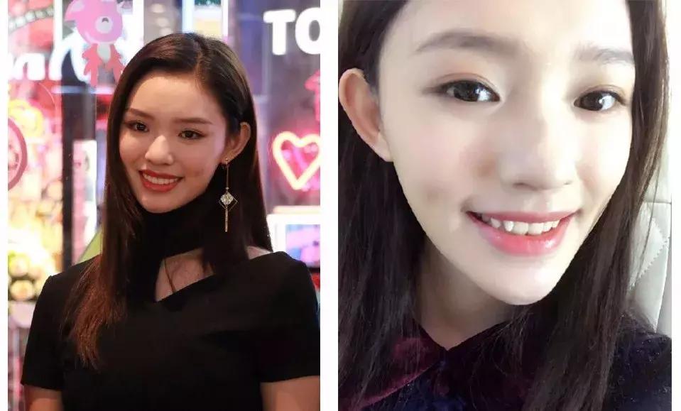 牙黄还不整齐，再美张嘴也输了你知道吗？