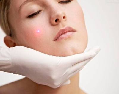 祛斑激光后如何选择护肤品,40多岁祛斑用什么激光好