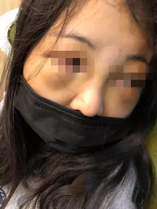 杭州女生打呼噜被舍友卡脖子,大学生打呼噜被舍友打后续