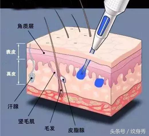 你知道纹身有多疼吗,告诉你纹身有多疼