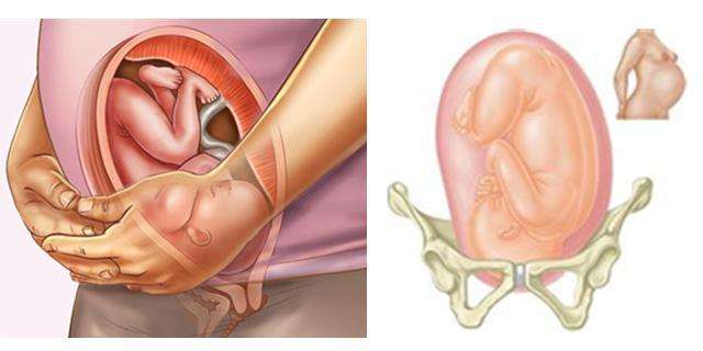 胎儿半入盆双顶径还长吗,胎儿半入盆了还动得那么厉害