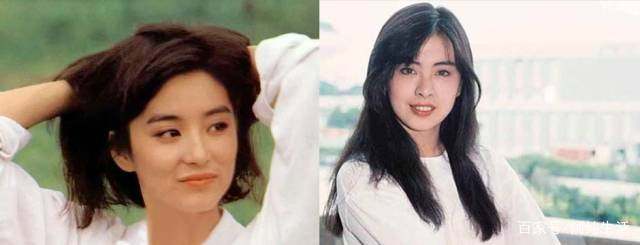 发际线脱发的原因和治疗方法,不要让发际线后移