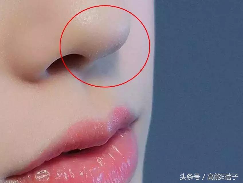 别傻了！蔡徐坤、Angelababy都根治不掉的黑头，微商神器能去除？