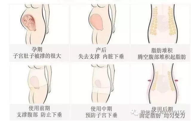 产后子宫恢复训练有哪些动作,生产后子宫多久恢复原来大小