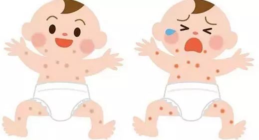 婴儿湿疹的原因及处理方法,湿疹怎么引起的小孩
