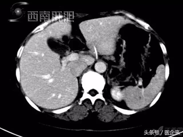 不可思议奇怪的东西,不可思议小物件穿透
