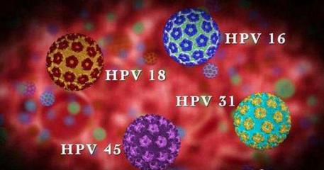 听病理医学专家讲座发朋友圈,人乳头状瘤病毒18阳性是什么意思