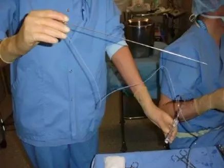 20岁女大学生捐卵事件18年,女大学生捐卵致富