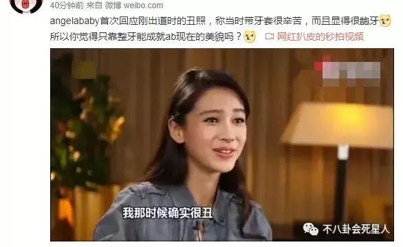 高圆圆戴牙套的脸型变化图,高圆圆戴牙套前后对比照