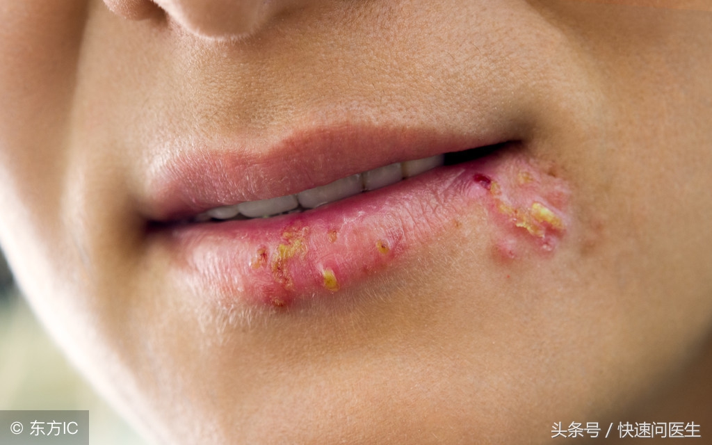 经常擦口红的唇会出现什么问题,女生经常擦唇膏代表什么