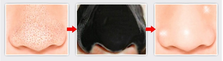 让鼻子变小变挺的方法,怎样才能让鼻子变小呢