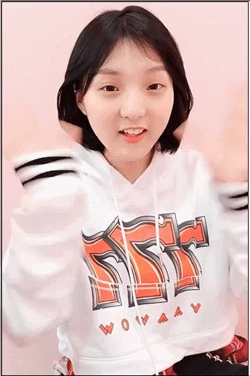 阿娇整牙,阿娇整牙前后对比