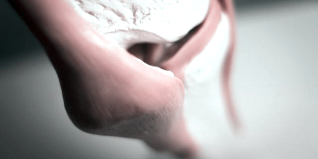 摘除了半月板,摘除了半月板可以用什么恢复器材