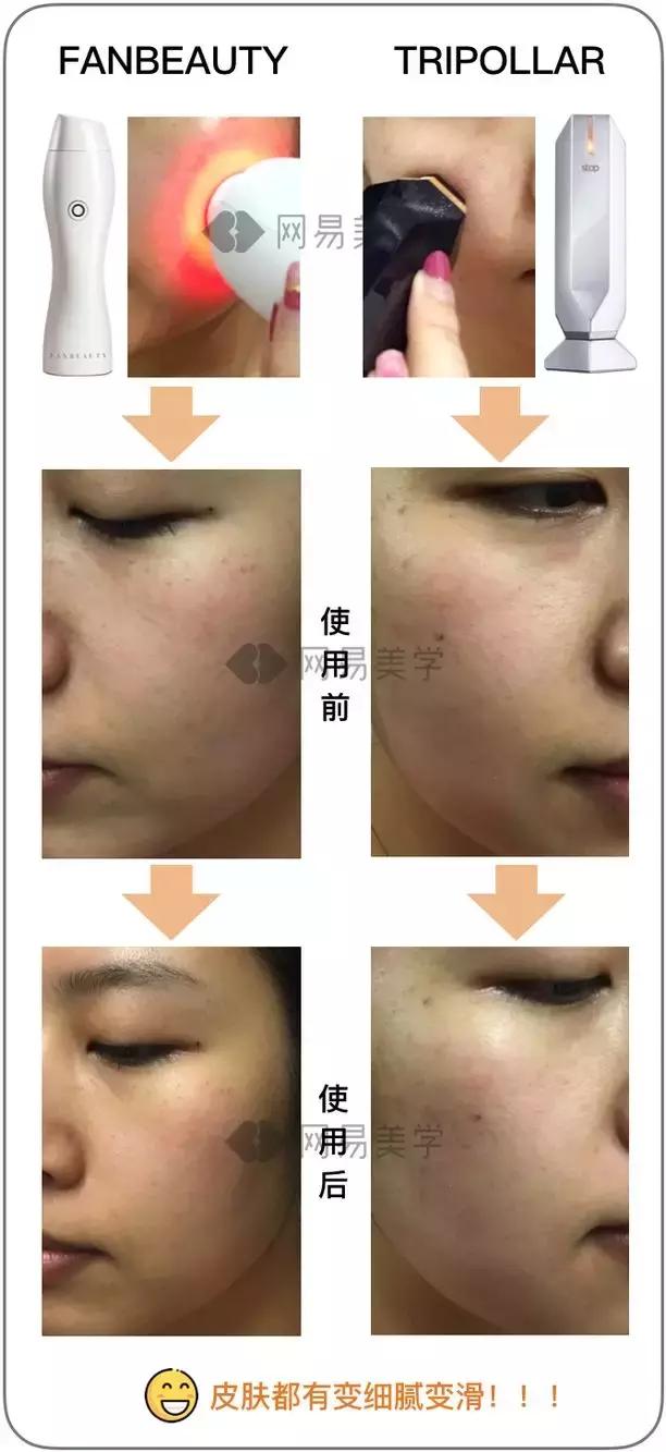 范冰冰出的射频美容仪首批测评,范冰冰美容仪真的好用吗视频