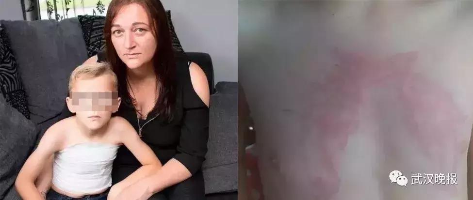 「健康」他在巴厘岛尝鲜特色服务,现在可能一辈子消不掉……悔恨啊!