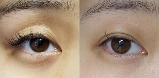 爱笑的女孩法令纹都很深,爱笑的女孩有法令纹怎么办