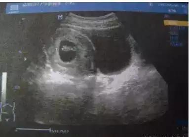 怀孕期间妈妈的直觉准吗,怀孕期间女人的直觉是不是很准