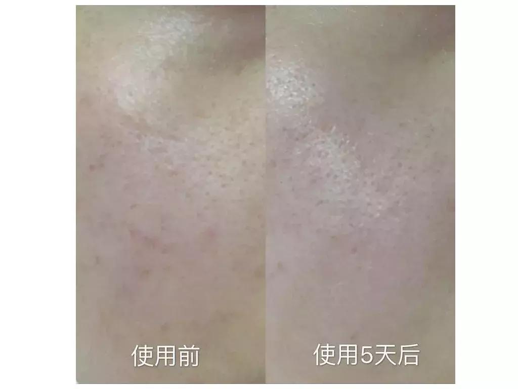 不吹不黑｜这款cosme大赏NO.1的逆龄精华好用吗？