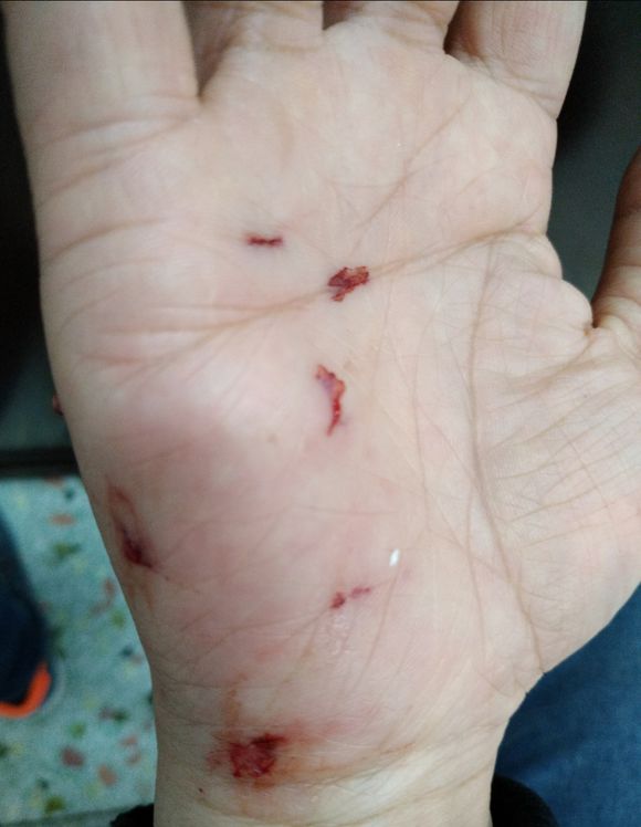 主人被自己的狗咬了应该怎么办,自家狗咬到人了怎么办