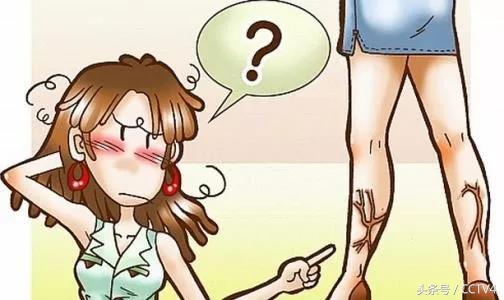 蚯蚓纹是怎么回事呢,大腿根部蚯蚓纹越来越多